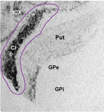 Figure 2: Kappa-opioid receptors are highly expressed in the claustrum. Figure 2: Kappa-opioid receptors are highly expressed in the claustrum.